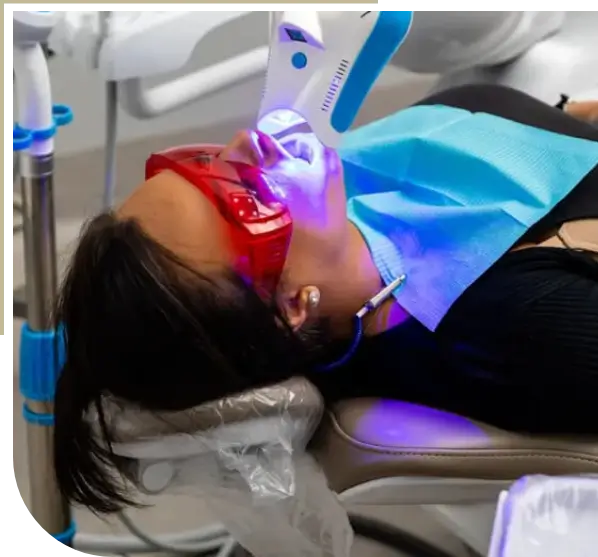 Benefits of Teeth Whitening Dvine Smiles Clinic