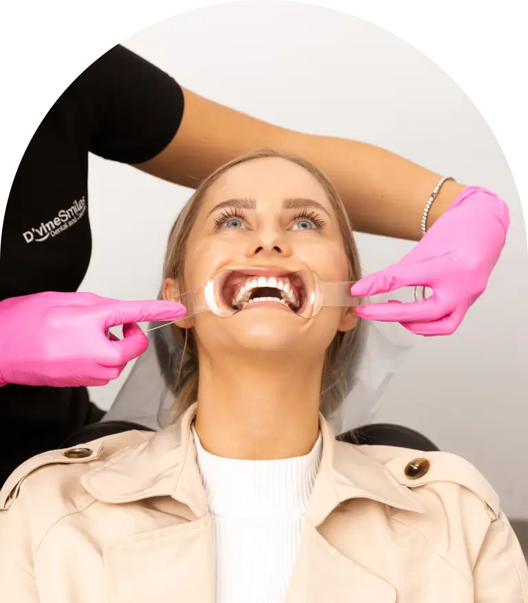 Process of Dental Crowns at Dvine Smiles