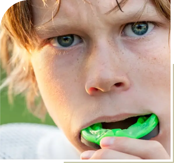 Why choose D'vine Smiles for mouthguards