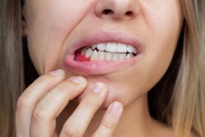 what to use for toothache during pregnancy gums